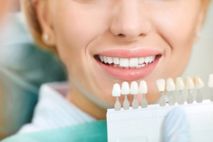 Teeth Whitening Sydney