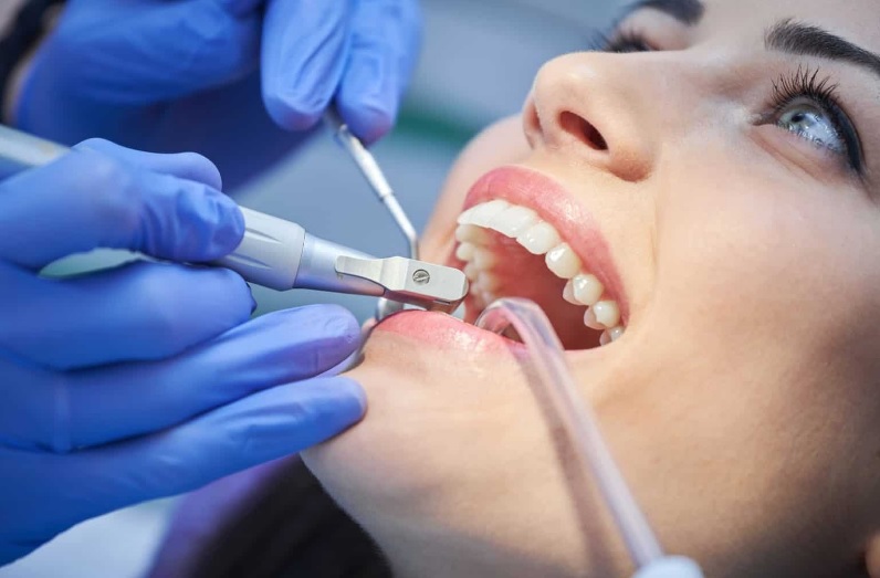 teeth cleaning Sydney