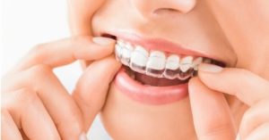 invisalign cost sydney
