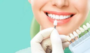 How are teeth prepped for veneers