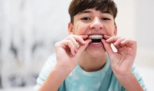 Invisalign for teens