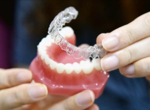 how does invisalign work