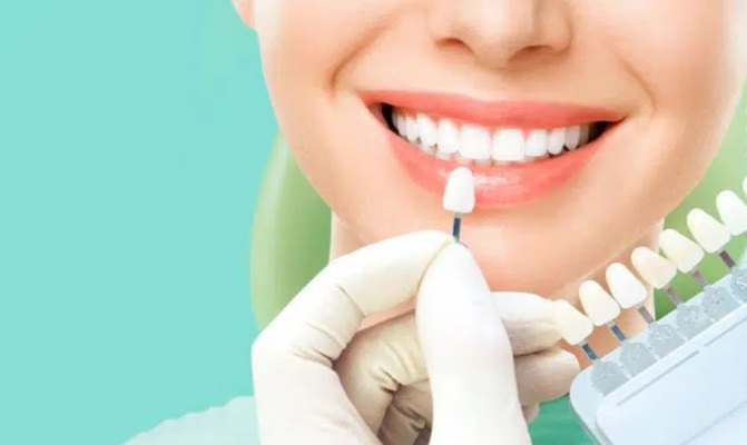 Difference Between Porcelain Crowns and Veneers