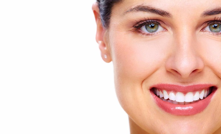 How Long Do Veneers Take?