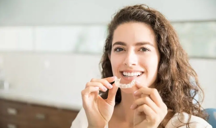 Invisalign Process