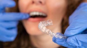 What Can Invisalign Fix