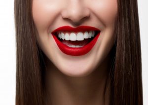 Invisalign and Teeth Whitening