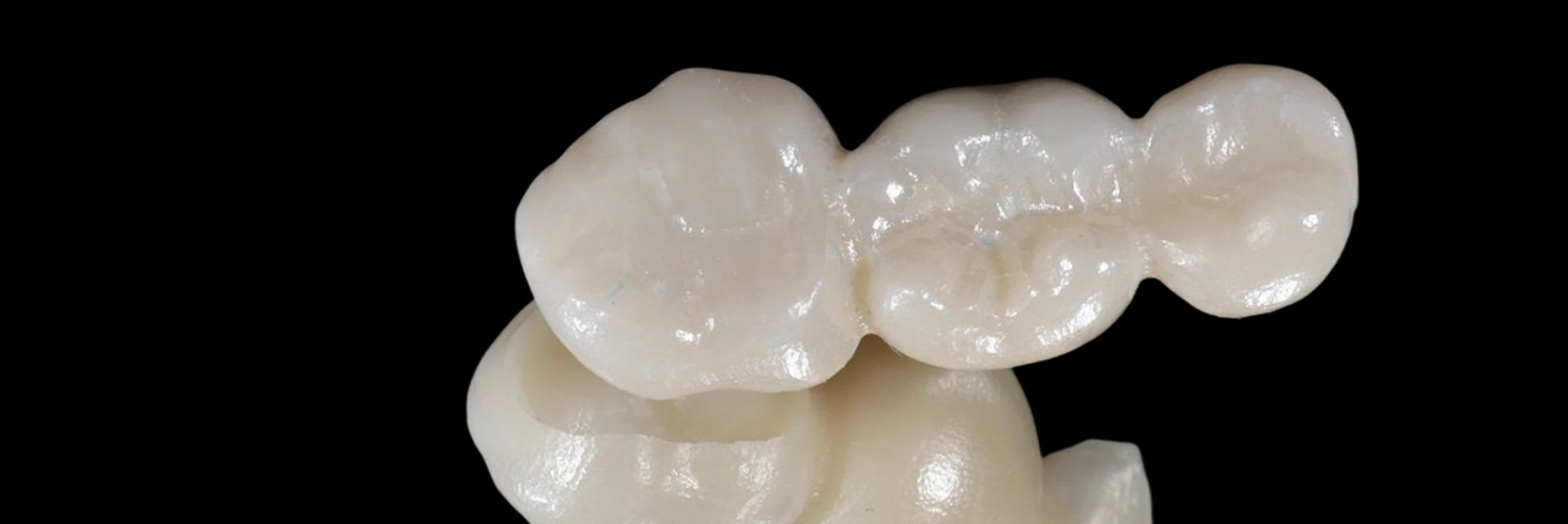 Dental Bridges In Cosmetique Dental™ Visit our clinics in North Sydney, the Sydney CBD, Bondi Junction, Parramatta, Macquarie Park, Hornsby and Canberra for dental bridges.