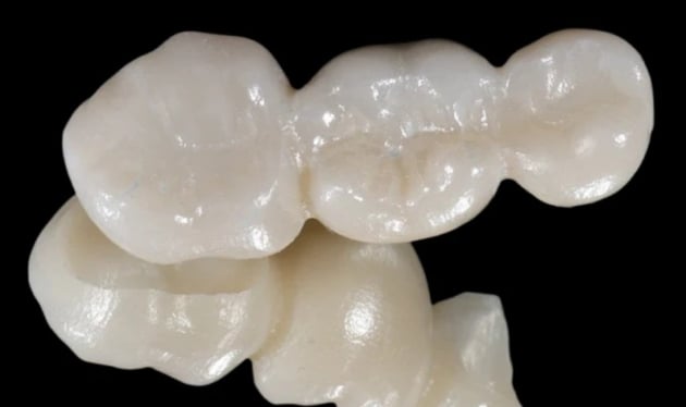 Dental Bridges Sydney and Canberra Sydney and Canberra at Cosmetique Dental™