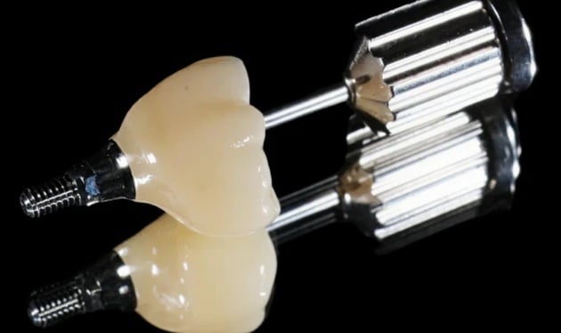 Dental Implants Sydney and Canberra Sydney and Canberra at Cosmetique Dental™