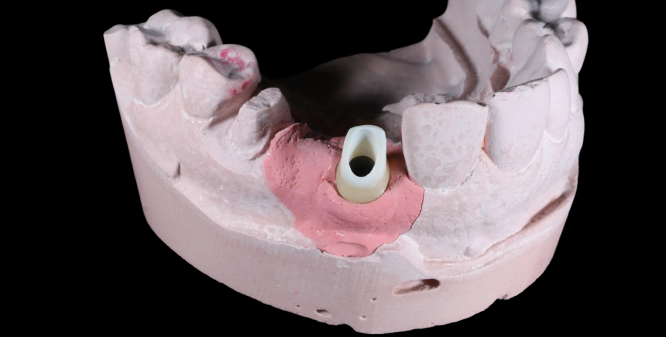 Restorative Dentistry In Cosmetique Dental™ Visit our dental clinics in North Sydney, the Sydney CBD, Bondi Junction, Parramatta, Macquarie Park, Hornsby and Canberra for restorative dentistry.