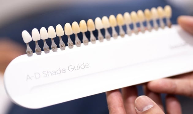 Teeth Whitening