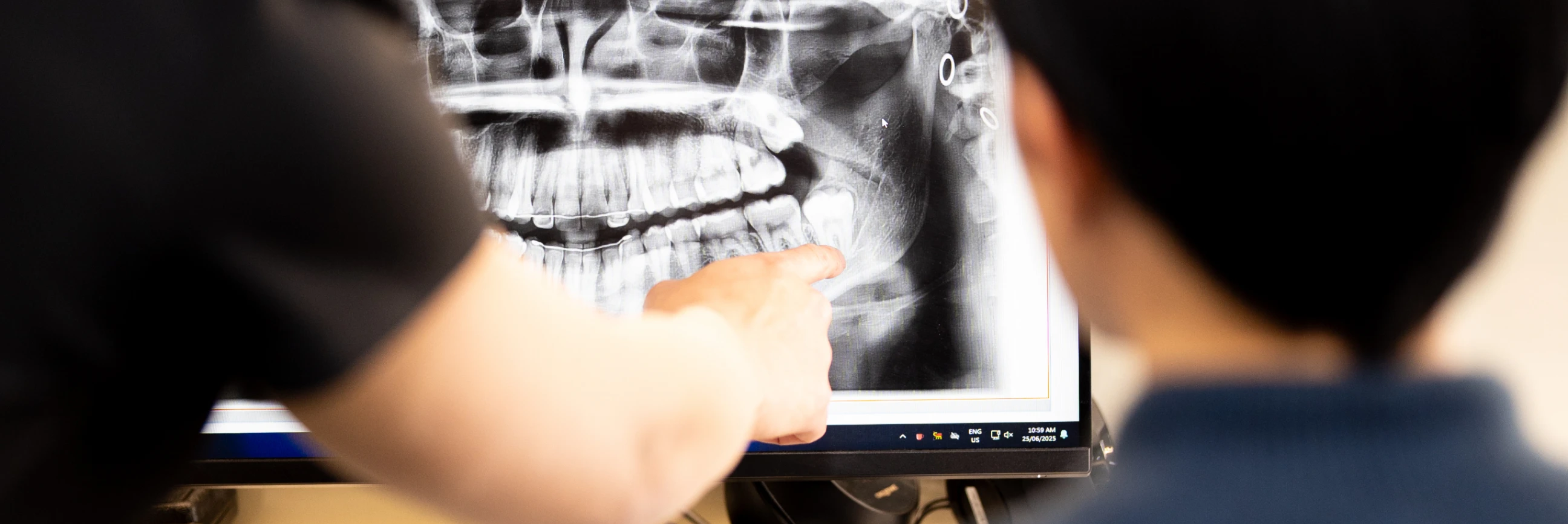 Wisdom Teeth Removal In Cosmetique Dental™ Visit our dental clinics in North Sydney, the Sydney CBD, Bondi Junction, Parramatta, Macquarie Park, Hornsby and Canberra for wisdom teeth removal.
