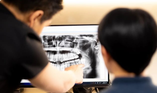 Wisdom Teeth Removal Sydney and Canberra Sydney and Canberra at Cosmetique Dental™