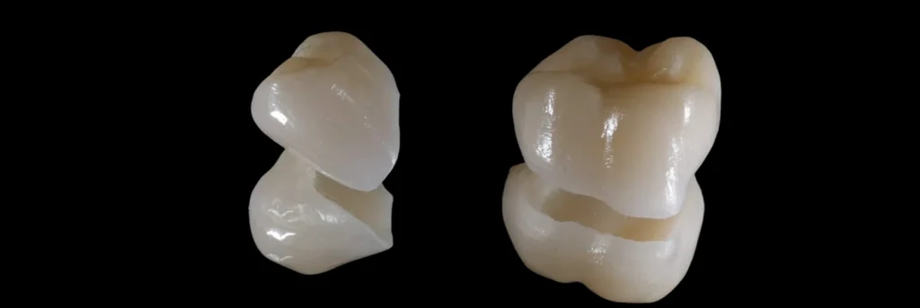 Porcelain Crowns In Cosmetique Dental™ Visit our clinics in North Sydney, the Sydney CBD, Bondi Junction, Parramatta, Macquarie Park, Hornsby and Canberra for porcelain crowns.