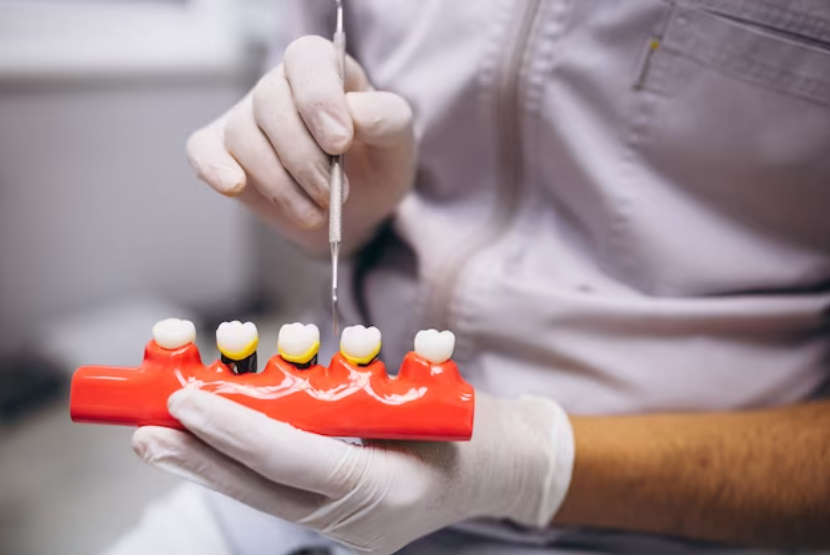 Dental Filling Stages: Understanding the Factors and Considerations