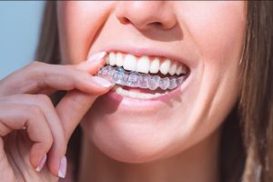 Does Invisalign Hurt?
