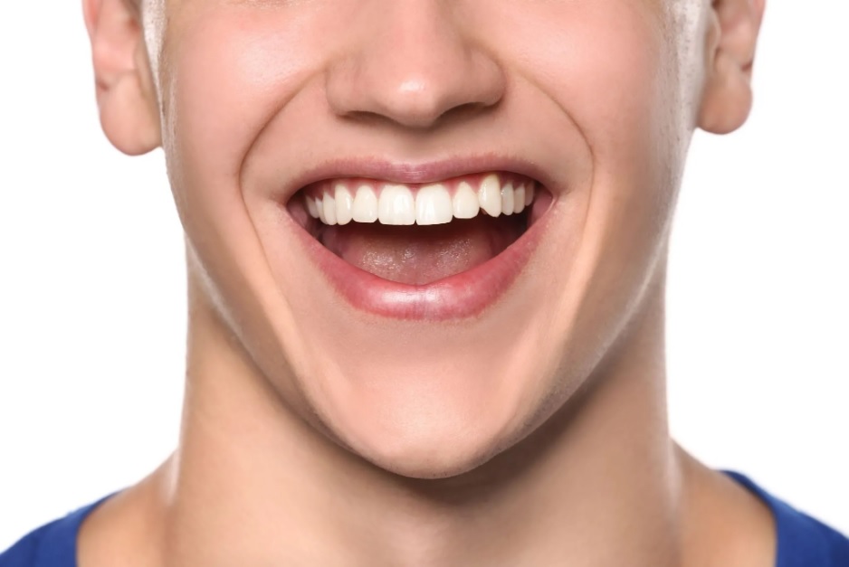 How Long Do Veneers Last?