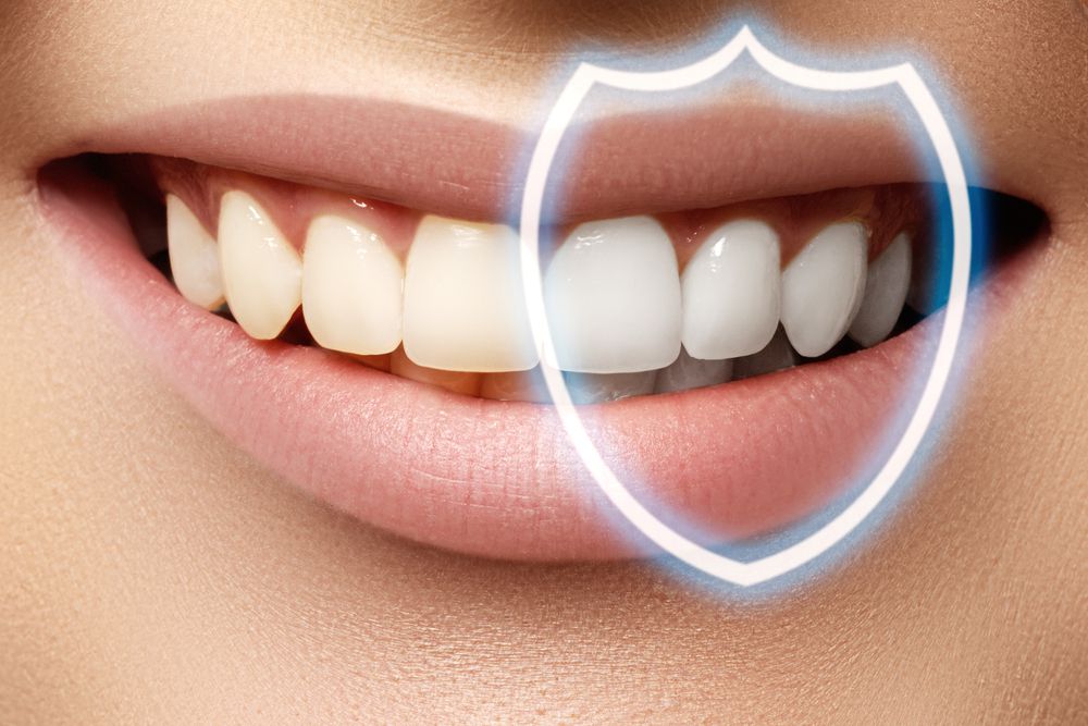How To Protect Your Teeth During Sports Activities