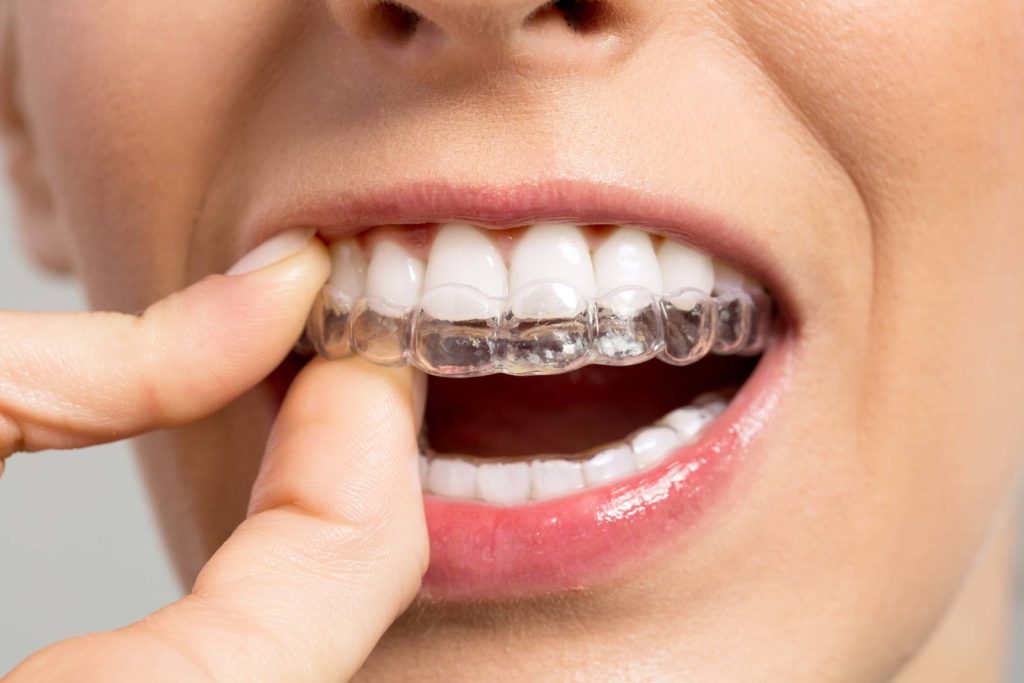 How To Protect Your Teeth During Winters
