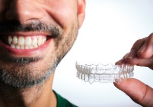 Invisalign Aligners
