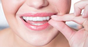 Invisalign Australia
