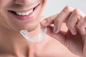 Invisalign Payment Plan