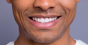 Porcelain Veneers Package