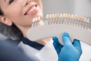 Porcelain Veneers Price