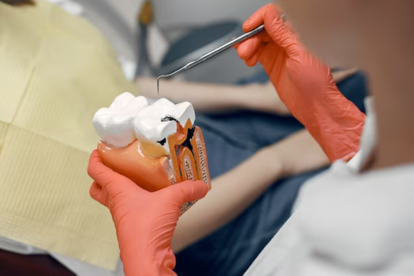 Recognising the Telltale Signs: Identifying the Need for a Root Canal