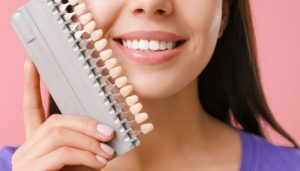 Should I Get Porcelain Veneers?
