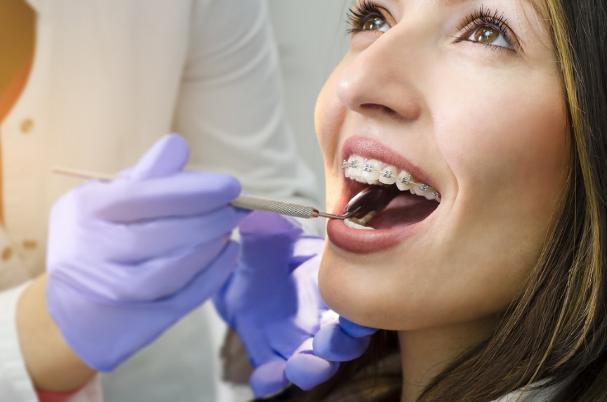 Traditional Braces