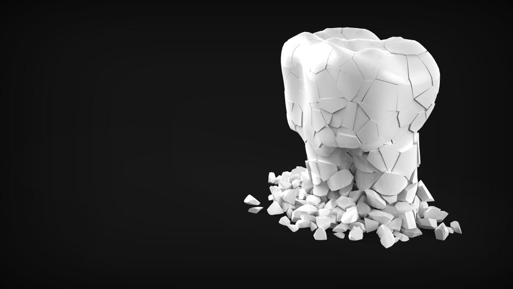 Why Ignoring Dental Problems Can Be Harmful