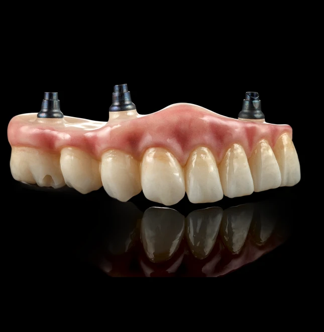 All Teeth On Implants In Cosmetique Dental™ Same-Day All-Teeth-On-Implants in Sydney: Possible