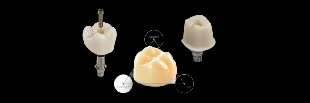 CEREC Same-Day Crowns in Cosmetique Dental™ Visit our clinics in North Sydney, the Sydney CBD, Bondi Junction, Parramatta, Macquarie Park, Hornsby and Canberra for CEREC Same-Day Crowns.