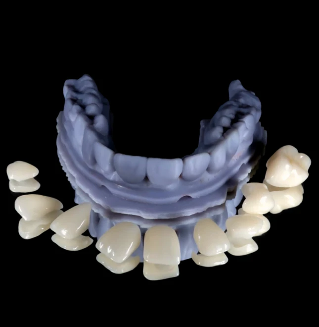 Porcelain Veneers In Cosmetique Dental™