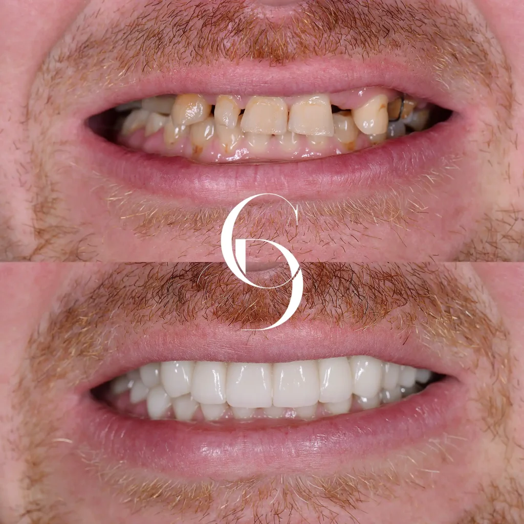 Ramos's Dental Implants In Cosmetique Dental™