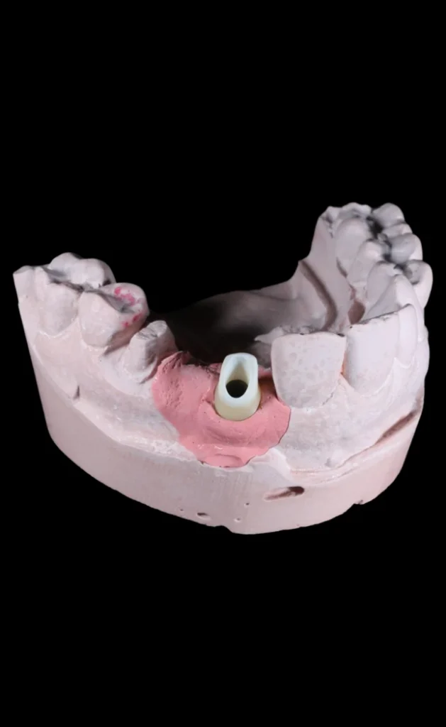 Restorative Dentistry In Cosmetique Dental™