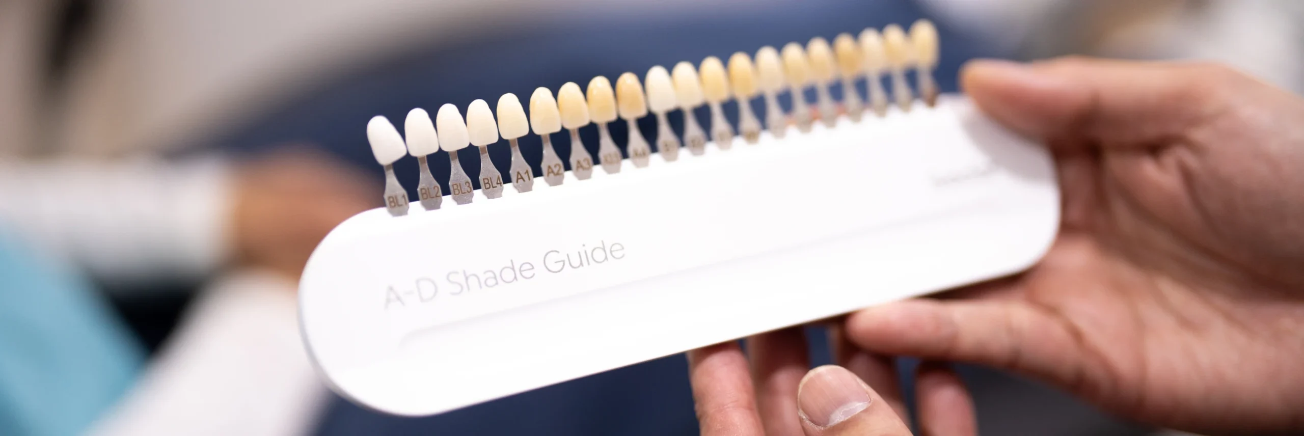 Teeth Whitening In Cosmetique Dental™ Sydney Dental Veneers Longevity: Will My Porcelain Veneers Actually Last?