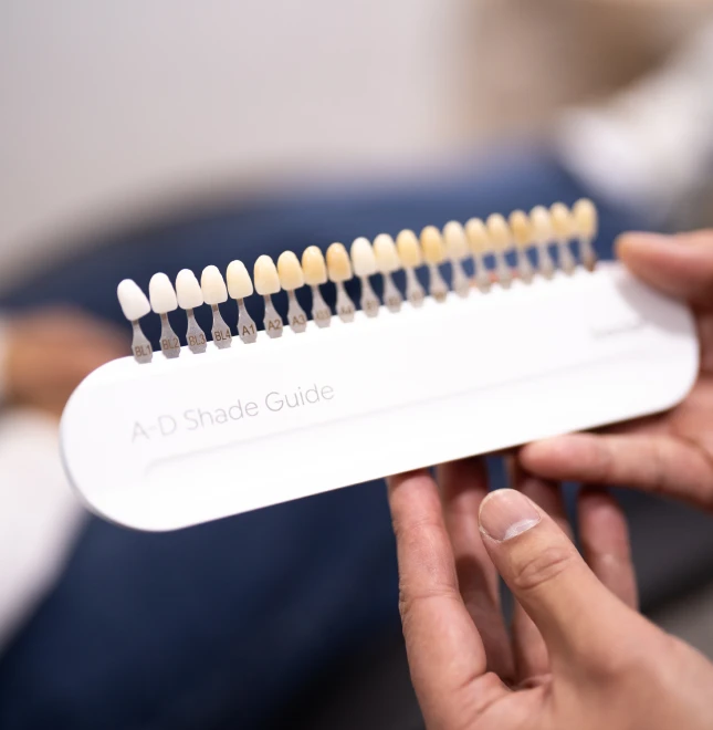 Teeth Whitening In Cosmetique Dental™