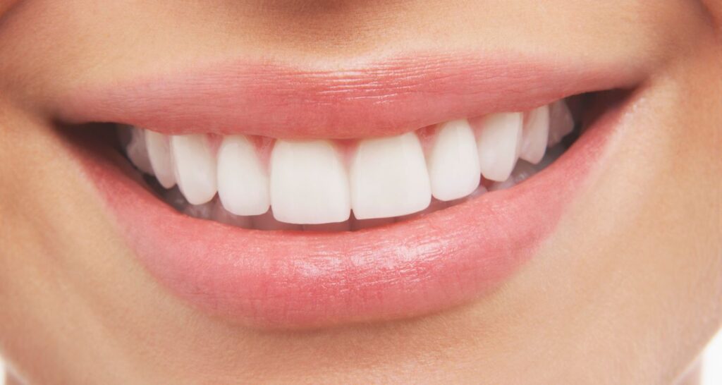 Smile Makeover Consultation In Sydney Cosmetique Dental