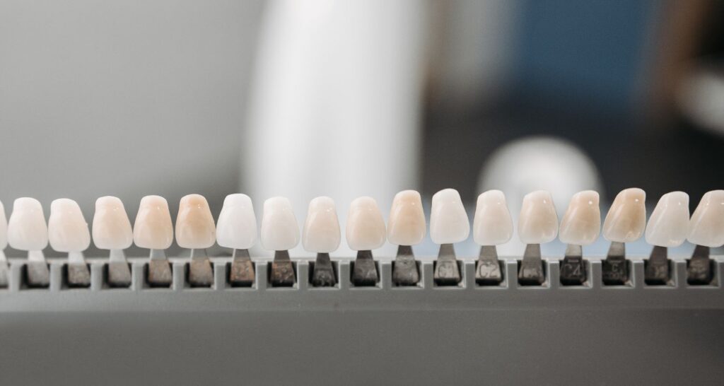 The In House Dental Lab Advantage For Porcelain Veneers In Cosmetique Dental