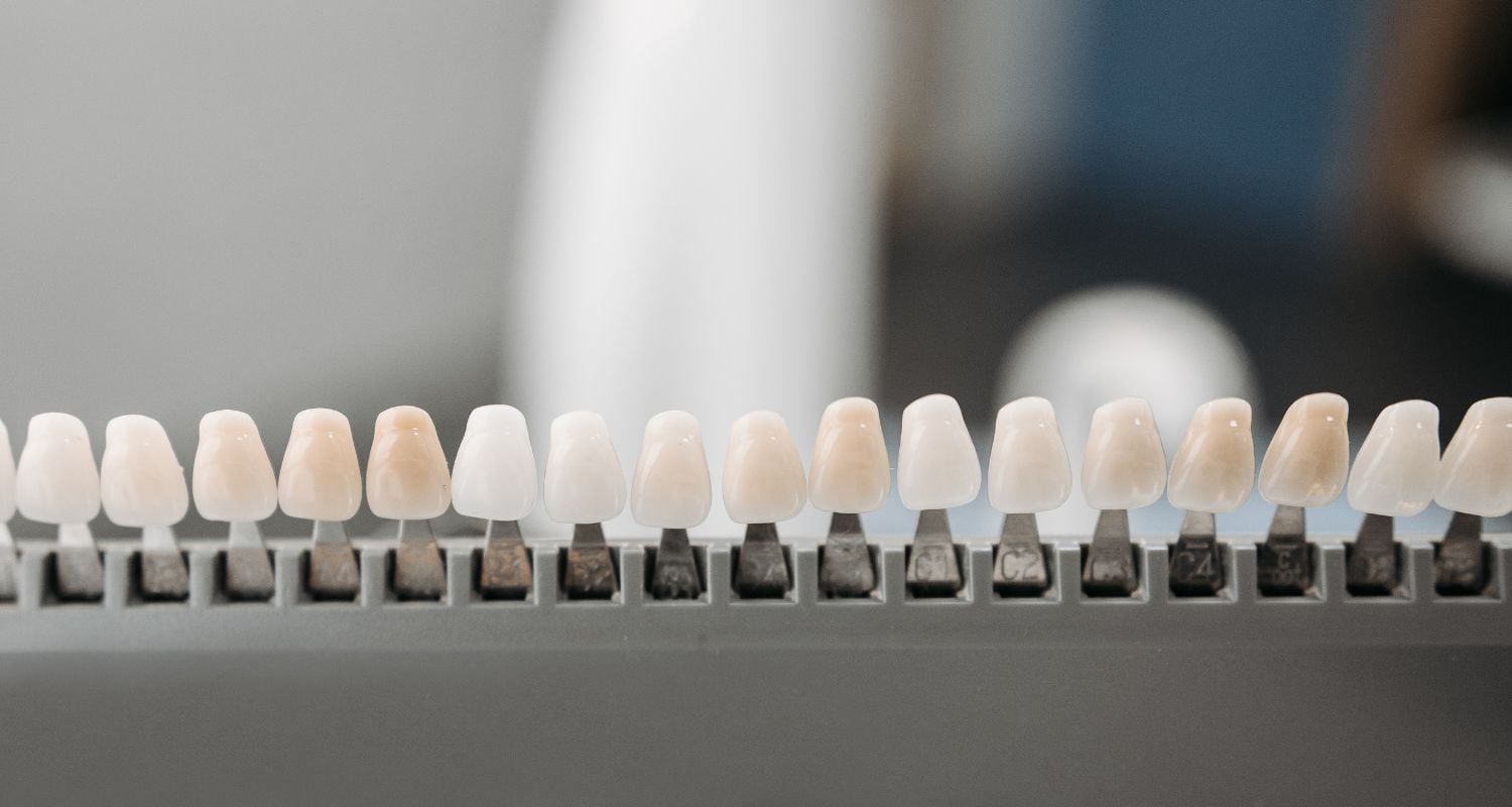 The In House Dental Lab Advantage For Porcelain Veneers In Cosmetique Dental