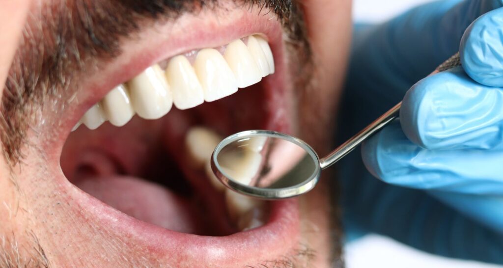 Your Dental Diet Guide In Cosmetique Dental