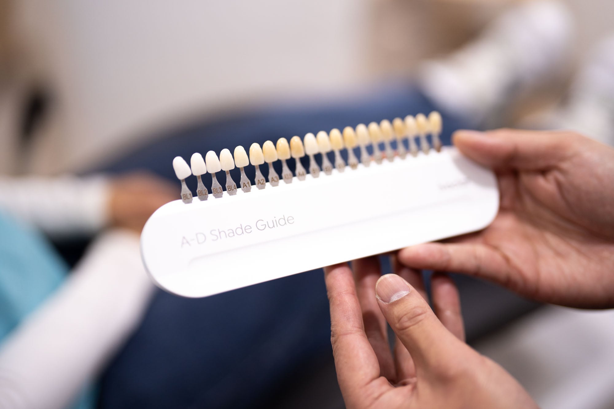 Can I Get Same Day Veneers in Canberra?