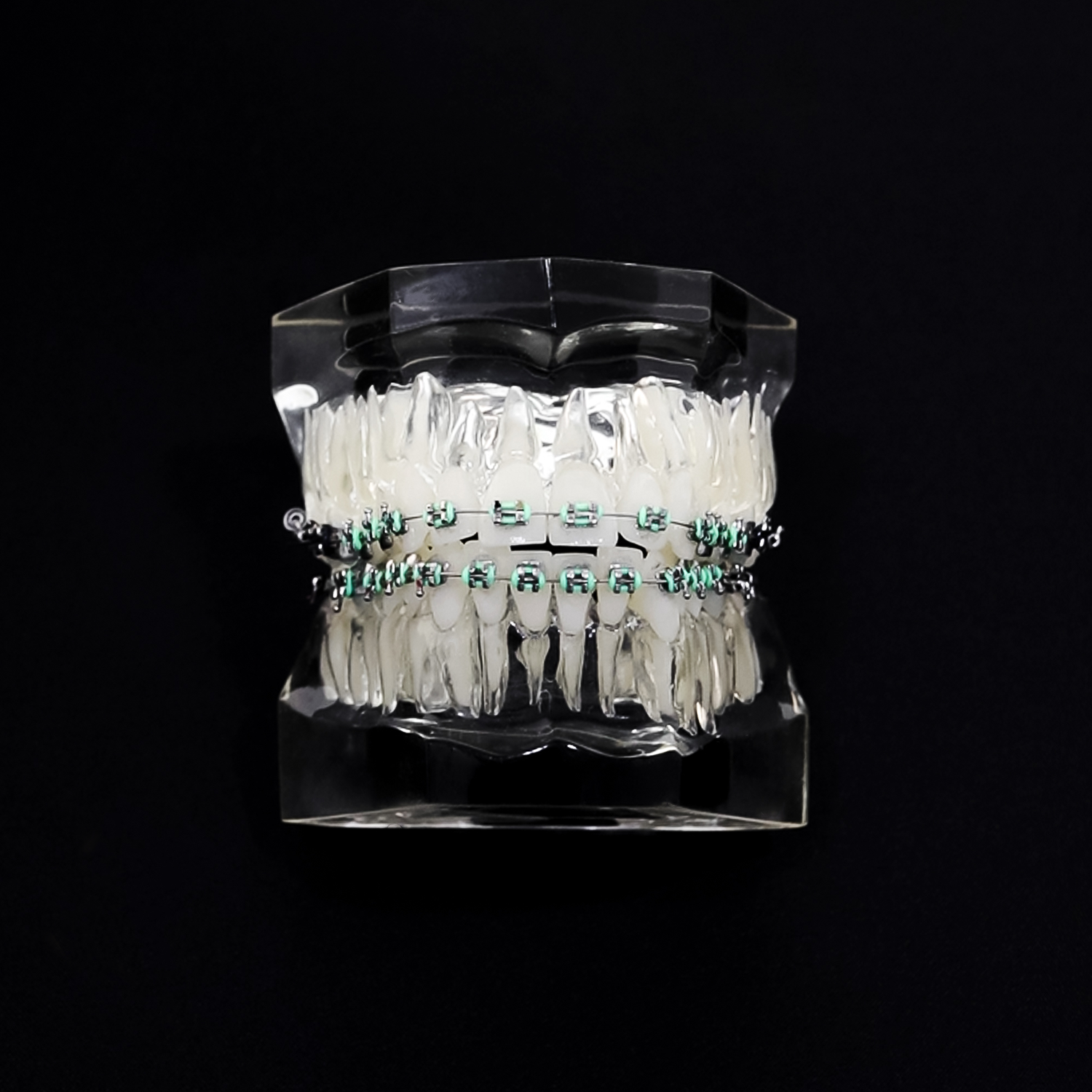 Dental Braces at Cosmetique Dental
