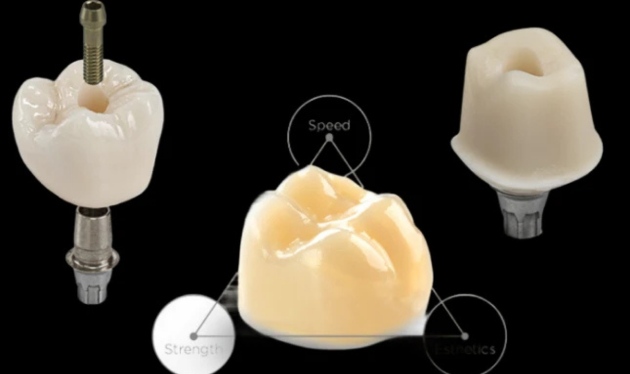 CEREC Same-Day Crowns at Cosmetique Dental