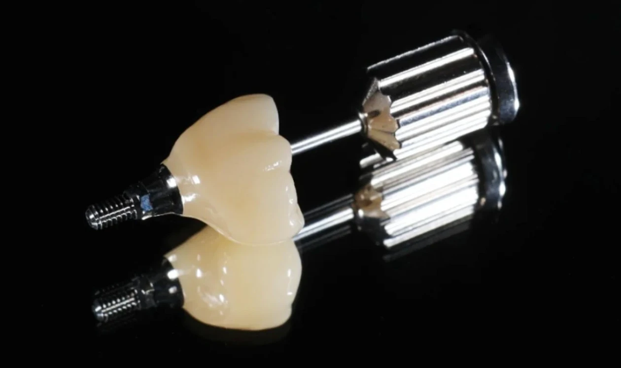 Dental Implants at Cosmetique Dental